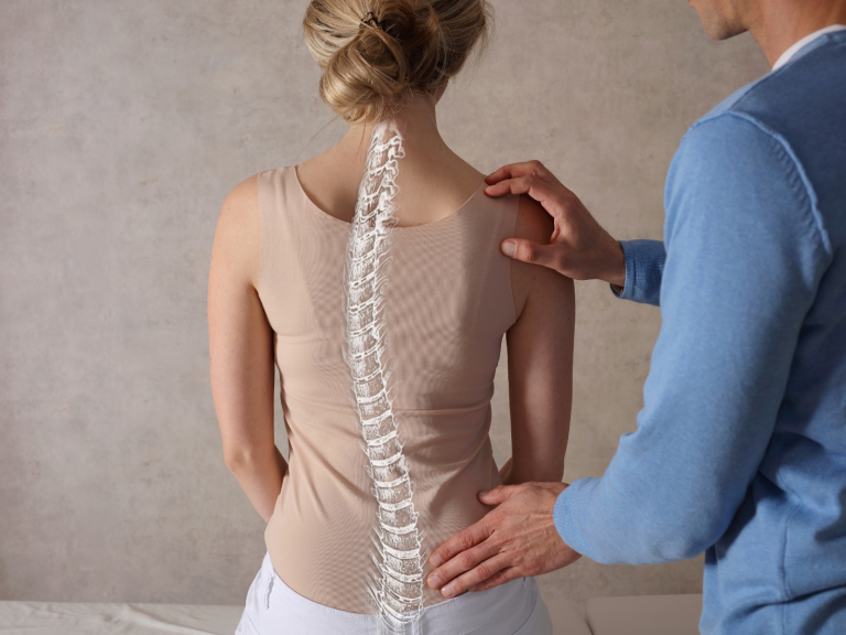 Scoliosis